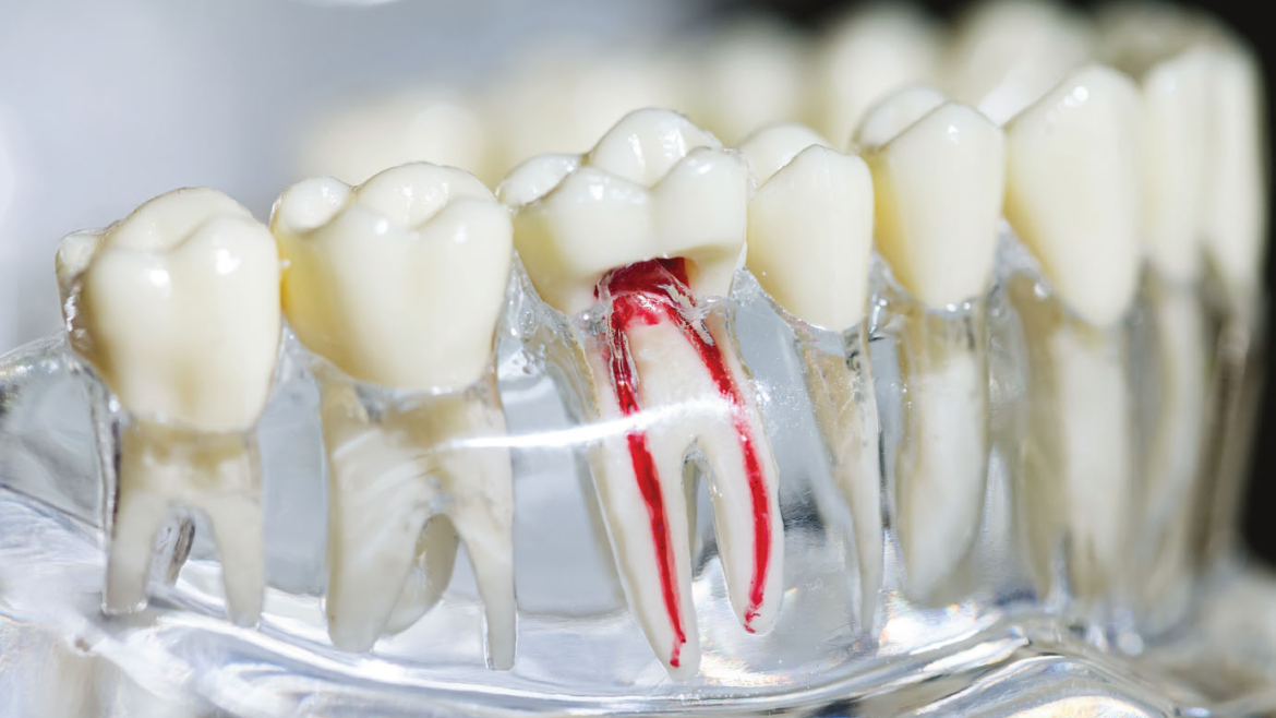 Endodontics